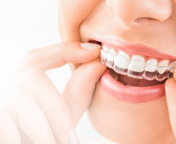 Dental Rituals