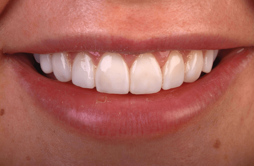 Smile Gallery - Dental Rituals | Dentist in Gildersome, Leeds