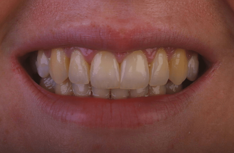 Teeth Whitening Dental Rituals Dentist in Gildersome, Leeds