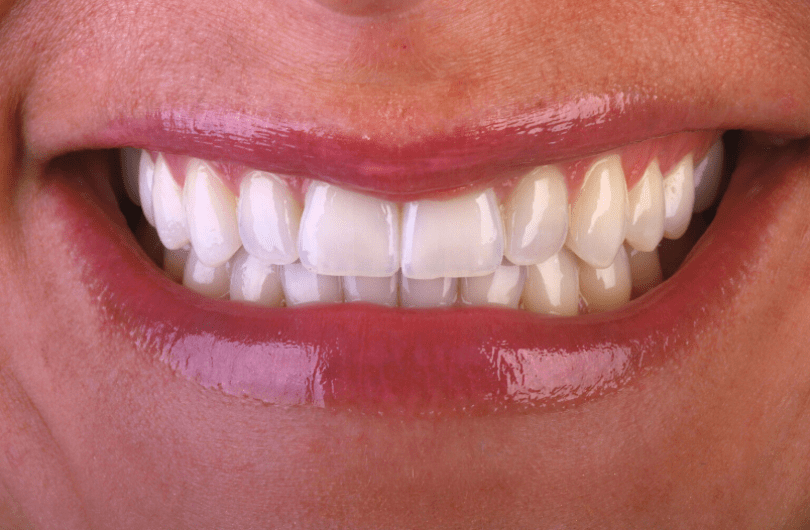 After - Dental Rituals