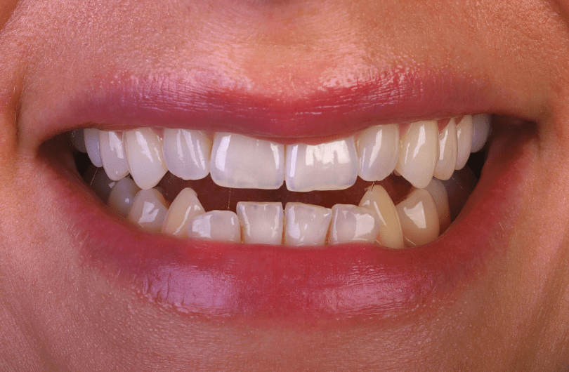 Before - Dental Rituals