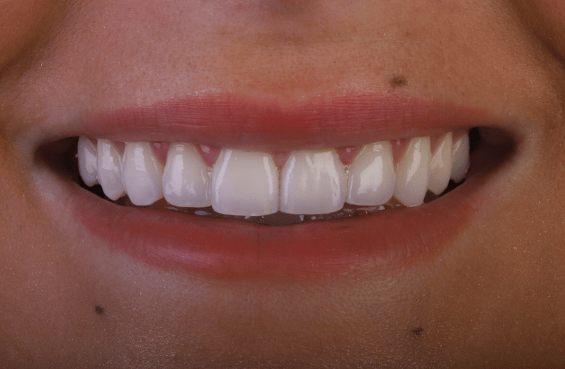 After - Dental Rituals