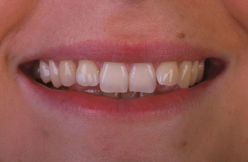 Before - Dental Rituals