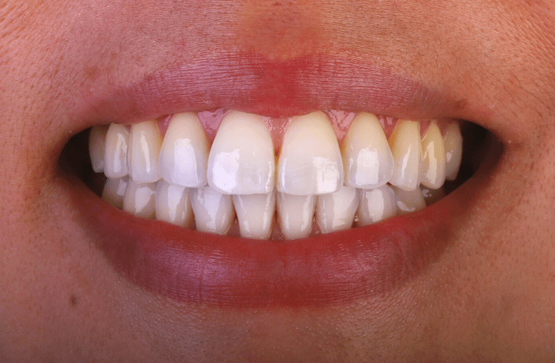 After - Dental Rituals