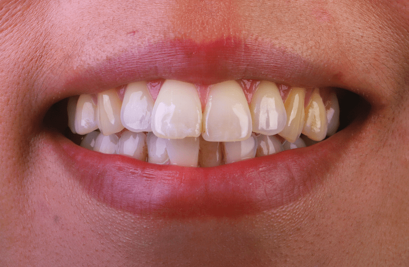 Before - Dental Rituals