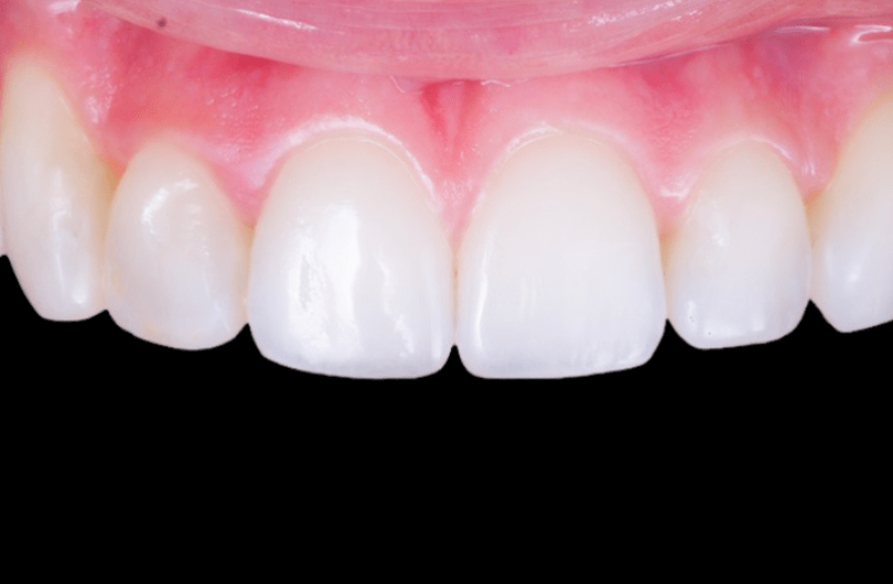 After - Dental Rituals