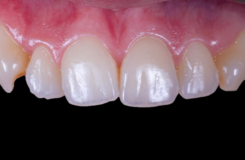 Before - Dental Rituals