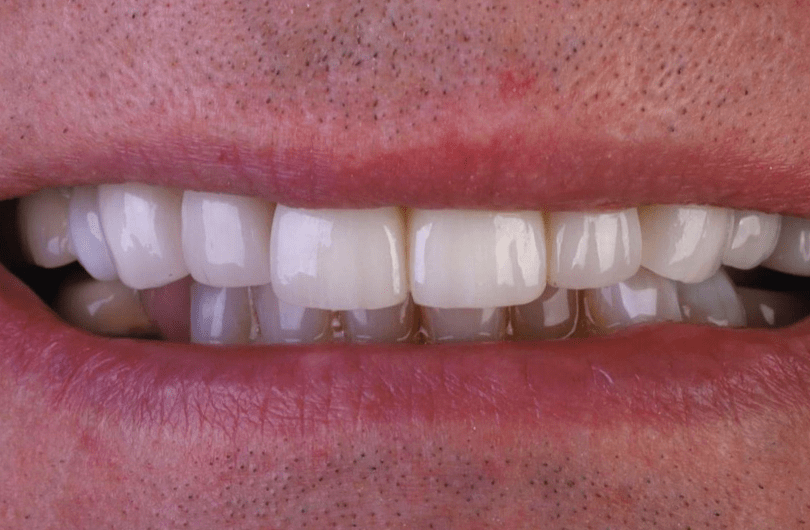 After - Dental Rituals