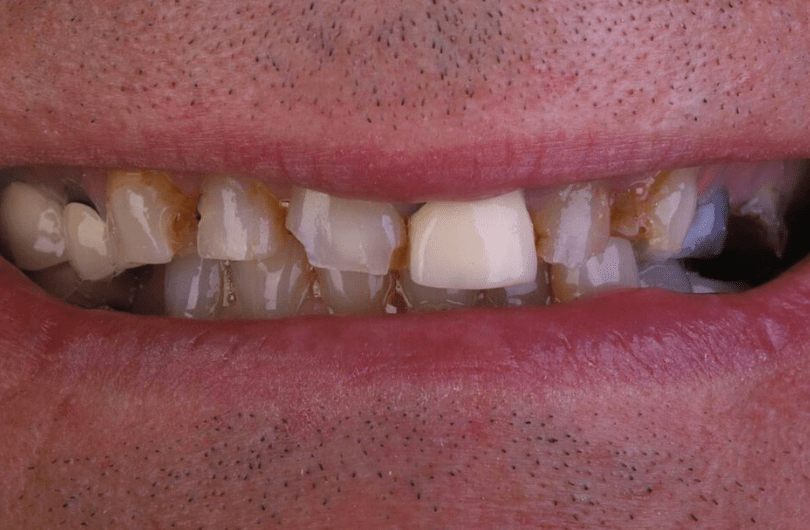 Before - Dental Rituals