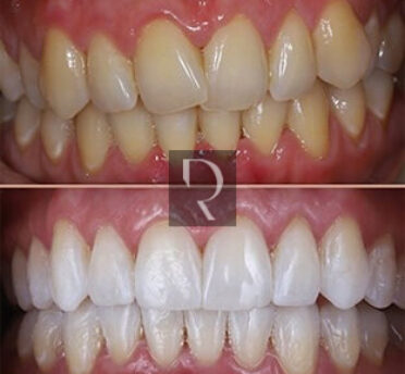 Dental Rituals